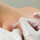 Six Things to Know About Therapeutic Dry Needling