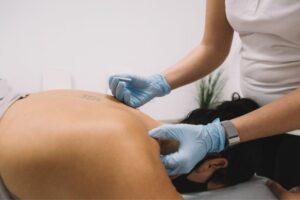 dry needling for muscle pain treatment